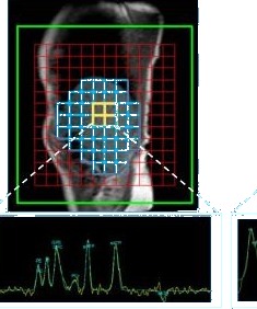 Liver ³¹P MRS spectrum with annotated metabolite peaks
